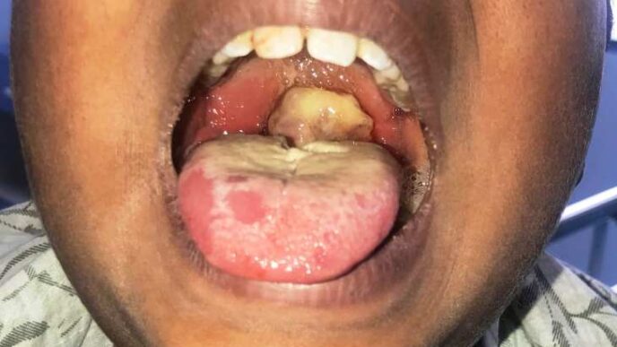 An outbreak of suspected diphtheria disease has claimed three lives in Zaria, Kaduna State, with six others infected. 