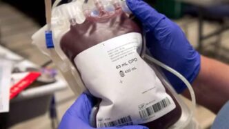 Jehovah’s Witnesses review blood transfusion doctrine, allow self-donation