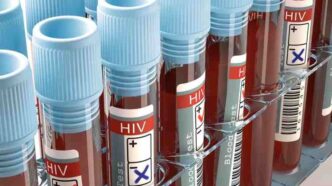 Lagos tops as Nigeria records 102,025 new HIV cases 