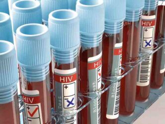 Lagos tops as Nigeria records 102,025 new HIV cases 